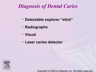Copyright © 2005 by Elsevier Inc. All rights reserved.
Diagnosis of Dental Caries
• Detectable explorer “stick”
• Radiographs
• Visual
• Laser caries detector
 