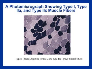 A Photomicrograph Showing Type I, Type IIa, and Type IIx Muscle Fibers Type I (black), type IIa (white), and type IIx (gray) muscle fibers 