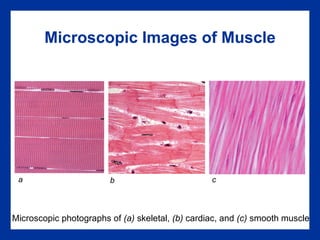 Microscopic Images of Muscle Microscopic photographs of  (a)  skeletal,  (b)  cardiac, and  (c)  smooth muscle a b c 
