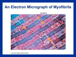 An Electron Micrograph of Myofibrils © Custom Medical Stock Photo Myofibrils 
