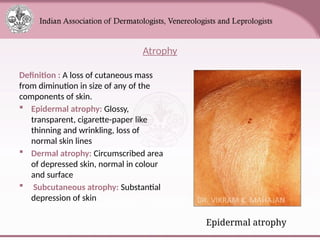 Comprehensive Overview of Skin Anatomy and Lesions for Medical ...