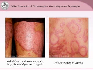 Chapter_01_Anatomy_of_Skin[1].pptx