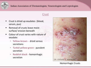 Chapter_01_Anatomy_of_Skin[1].pptx