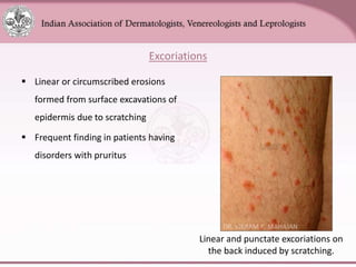 Chapter_01_Anatomy_of_Skin[1].pptx