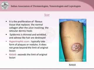 Chapter_01_Anatomy_of_Skin[1].pptx