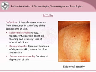 Chapter_01_Anatomy_of_Skin[1].pptx