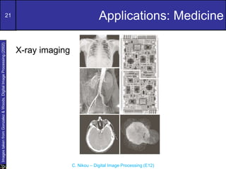 21
C. Nikou – Digital Image Processing (E12)
Applications: Medicine
Images
taken
from
Gonzalez
&
Woods,
Digital
Image
Processing
(2002)
X-ray imaging
 