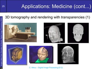 25
C. Nikou – Digital Image Processing (E12)
Applications: Medicine (cont...)
Images
taken
from
Gonzalez
&
Woods,
Digital
Image
Processing
(2002)
3D tomography and rendering with transparencies (1)
 