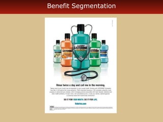 Benefit Segmentation 
 