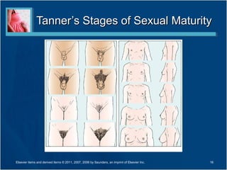 Tanner’s Stages of Sexual Maturity




Elsevier items and derived items © 2011, 2007, 2006 by Saunders, an imprint of Elsevier Inc.   16
 