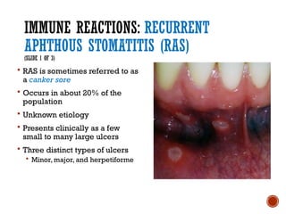 Minor Ras Ulcers Chapter_025 - Oral Conditions and their Treatment 2.pptx
