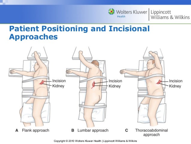 system of drainage kidney OF PATIENT DISORDER RENAL MANAGEMENT WITH