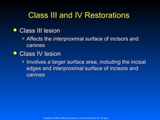 Class III and IV Restorations


Class III lesion




Affects the interproximal surface of incisors and
canines

Class IV lesion


Involves a larger surface area, including the incisal
edges and interproximal surface of incisors and
canines

Copyright © 2009, 2006 by Saunders, an imprint of Elsevier Inc. All rights

 