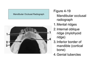Extraoral and Occlusal Anatomic Landmarks | PDF