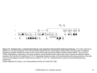 © 2020 Elsevier Inc. All rights reserved. 10
Figure 5–9. Pedigree from a mitochondrial disease case treated by mitochondrial replacement therapy. The mother referred for
treatment in this case (labeled as “III-9”) had previously experienced four miscarriages and two children who died early in childhood.
Sequencing analysis revealed the mother to be a carrier of the Leigh syndrome mutation (mtDNA mutation 8993T > G) at 23.27%–
33.65% heteroplasmy, depending on the tissue analyzed. Oocyte spindle transfer method was used to replace the defective mtDNA,
resulting in the live birth of a health boy (IV-12). To separately indicate the status of the mitochondrial and nuclear genomes in this child,
his box on the pedigree has been divided into two sections: “N” and “mt,” representing the nuclear and mitochondrial genomes,
respectively.
(Image originally from Zhang J, et al. Reprod Biomed Online 2017;34(4):361–368.)
 