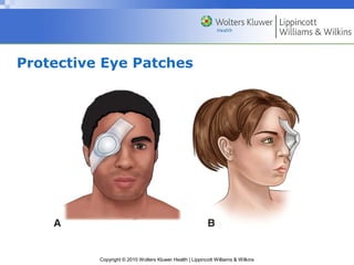 In Vision Patch ASSESSMENT AND MANAGEMENT OF PATIENT WITH EYE AND VISION DISORDER | PPT