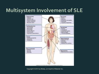sle ins and outs elaborated in detail explained | PPT