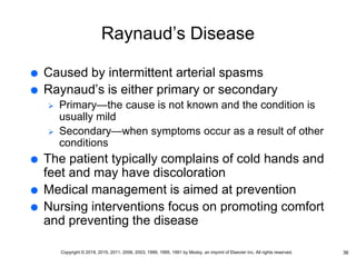 Raynaud’s Disease
 Caused by intermittent arterial spasms
 Raynaud’s is either primary or secondary
 Primary—the cause is not known and the condition is
usually mild
 Secondary—when symptoms occur as a result of other
conditions
 The patient typically complains of cold hands and
feet and may have discoloration
 Medical management is aimed at prevention
 Nursing interventions focus on promoting comfort
and preventing the disease
36
Copyright © 2019, 2015, 2011, 2006, 2003, 1999, 1995, 1991 by Mosby, an imprint of Elsevier Inc. All rights reserved.
 