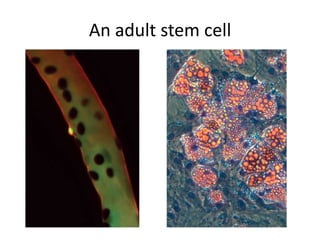 An adult stem cell
 