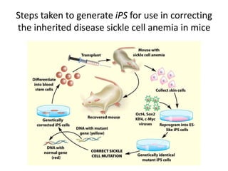 Steps taken to generate iPS for use in correcting
the inherited disease sickle cell anemia in mice
 