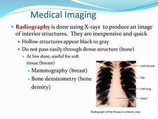 Medical Imaging
 Radiography is done using X-rays to produce an image
of interior structures. They are inexpensive and quick
 Hollow structures appear black or gray
 Do not pass easily through dense structure (bone)
 At low dose, useful for soft
tissue (breast)
 Mammography (breast)
 Bone densitometry (bone
density)
 