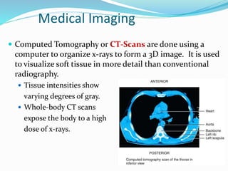 Medical Imaging
 Computed Tomography or CT-Scans are done using a
computer to organize x-rays to form a 3D image. It is used
to visualize soft tissue in more detail than conventional
radiography.
 Tissue intensities show
varying degrees of gray.
 Whole-body CT scans
expose the body to a high
dose of x-rays.
 