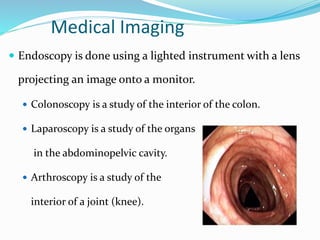 Medical Imaging
 Endoscopy is done using a lighted instrument with a lens
projecting an image onto a monitor.
 Colonoscopy is a study of the interior of the colon.
 Laparoscopy is a study of the organs
in the abdominopelvic cavity.
 Arthroscopy is a study of the
interior of a joint (knee).
 