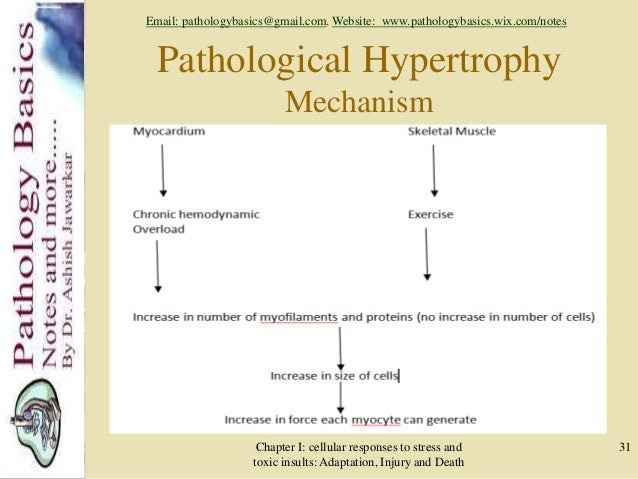 pathological hypertrophy examples pathological hypertrophy examples