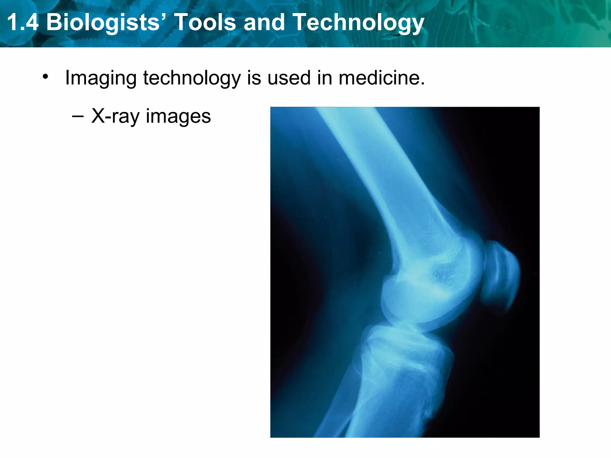 1.4 Biologists’ Tools and Technology
• Imaging technology is used in medicine.
– X-ray images
 