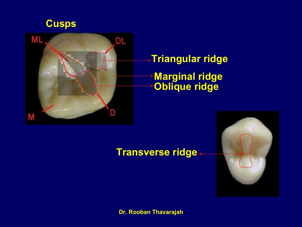 Cusp Slope Dental Definition at Viola Taormina blog