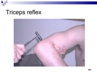 Triceps reflex 