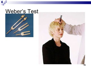 Weber’s Test 
