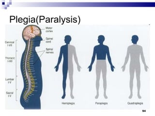 Plegia(Paralysis) 