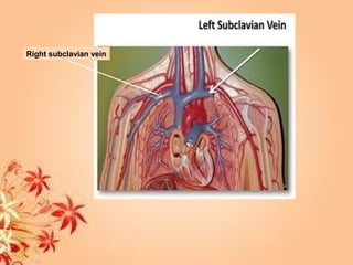 Right subclavian vein
 