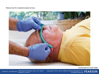 Prehospital Emergency Care, 10th
edition
Mistovich | Karren
Copyright © 2014, 2010, 2008 by Pearson Education, Inc.
All Rights Reserved
Measuring the nasopharyngeal airway.
continued on next slide
 