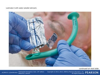 Prehospital Emergency Care, 10th
edition
Mistovich | Karren
Copyright © 2014, 2010, 2008 by Pearson Education, Inc.
All Rights Reserved
Lubricate it with water-soluble lubricant.
continued on next slide
 