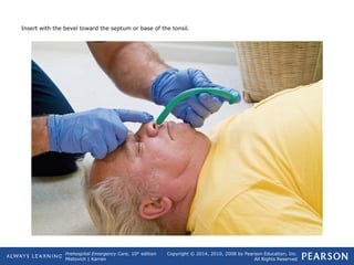 Prehospital Emergency Care, 10th
edition
Mistovich | Karren
Copyright © 2014, 2010, 2008 by Pearson Education, Inc.
All Rights Reserved
Insert with the bevel toward the septum or base of the tonsil.
 