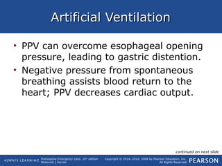 Prehospital Emergency Care, 10th
edition
Mistovich | Karren
Copyright © 2014, 2010, 2008 by Pearson Education, Inc.
All Rights Reserved
Artificial VentilationArtificial Ventilation
• PPV can overcome esophageal opening
pressure, leading to gastric distention.
• Negative pressure from spontaneous
breathing assists blood return to the
heart; PPV decreases cardiac output.
continued on next slide
 