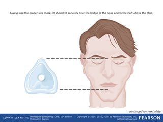 Prehospital Emergency Care, 10th
edition
Mistovich | Karren
Copyright © 2014, 2010, 2008 by Pearson Education, Inc.
All Rights Reserved
Always use the proper size mask. It should fit securely over the bridge of the nose and in the cleft above the chin.
continued on next slide
 
