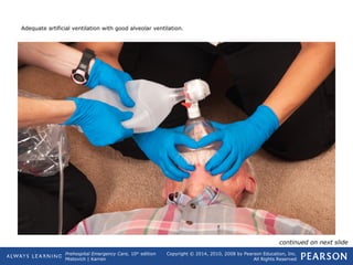 Prehospital Emergency Care, 10th
edition
Mistovich | Karren
Copyright © 2014, 2010, 2008 by Pearson Education, Inc.
All Rights Reserved
Adequate artificial ventilation with good alveolar ventilation.
continued on next slide
 