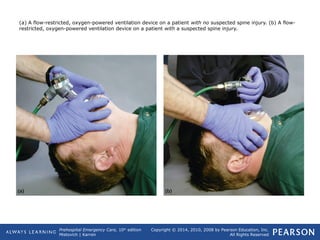 Prehospital Emergency Care, 10th
edition
Mistovich | Karren
Copyright © 2014, 2010, 2008 by Pearson Education, Inc.
All Rights Reserved
(a) A flow-restricted, oxygen-powered ventilation device on a patient with no suspected spine injury. (b) A flow-
restricted, oxygen-powered ventilation device on a patient with a suspected spine injury.
 