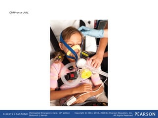 Prehospital Emergency Care, 10th
edition
Mistovich | Karren
Copyright © 2014, 2010, 2008 by Pearson Education, Inc.
All Rights Reserved
CPAP on a child.
 