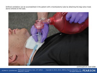 Prehospital Emergency Care, 10th
edition
Mistovich | Karren
Copyright © 2014, 2010, 2008 by Pearson Education, Inc.
All Rights Reserved
Artificial ventilation can be accomplished in the patient with a tracheostomy tube by attaching the bag-valve-mask
device directly to the tube.
continued on next slide
 