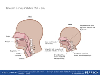Prehospital Emergency Care, 10th
edition
Mistovich | Karren
Copyright © 2014, 2010, 2008 by Pearson Education, Inc.
All Rights Reserved
Comparison of airways of adult and infant or child.
 