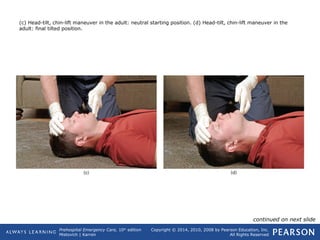 Prehospital Emergency Care, 10th
edition
Mistovich | Karren
Copyright © 2014, 2010, 2008 by Pearson Education, Inc.
All Rights Reserved
(c) Head-tilt, chin-lift maneuver in the adult: neutral starting position. (d) Head-tilt, chin-lift maneuver in the
adult: final tilted position.
continued on next slide
 