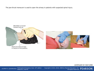 Prehospital Emergency Care, 10th
edition
Mistovich | Karren
Copyright © 2014, 2010, 2008 by Pearson Education, Inc.
All Rights Reserved
The jaw-thrust maneuver is used to open the airway in patients with suspected spinal injury.
continued on next slide
 