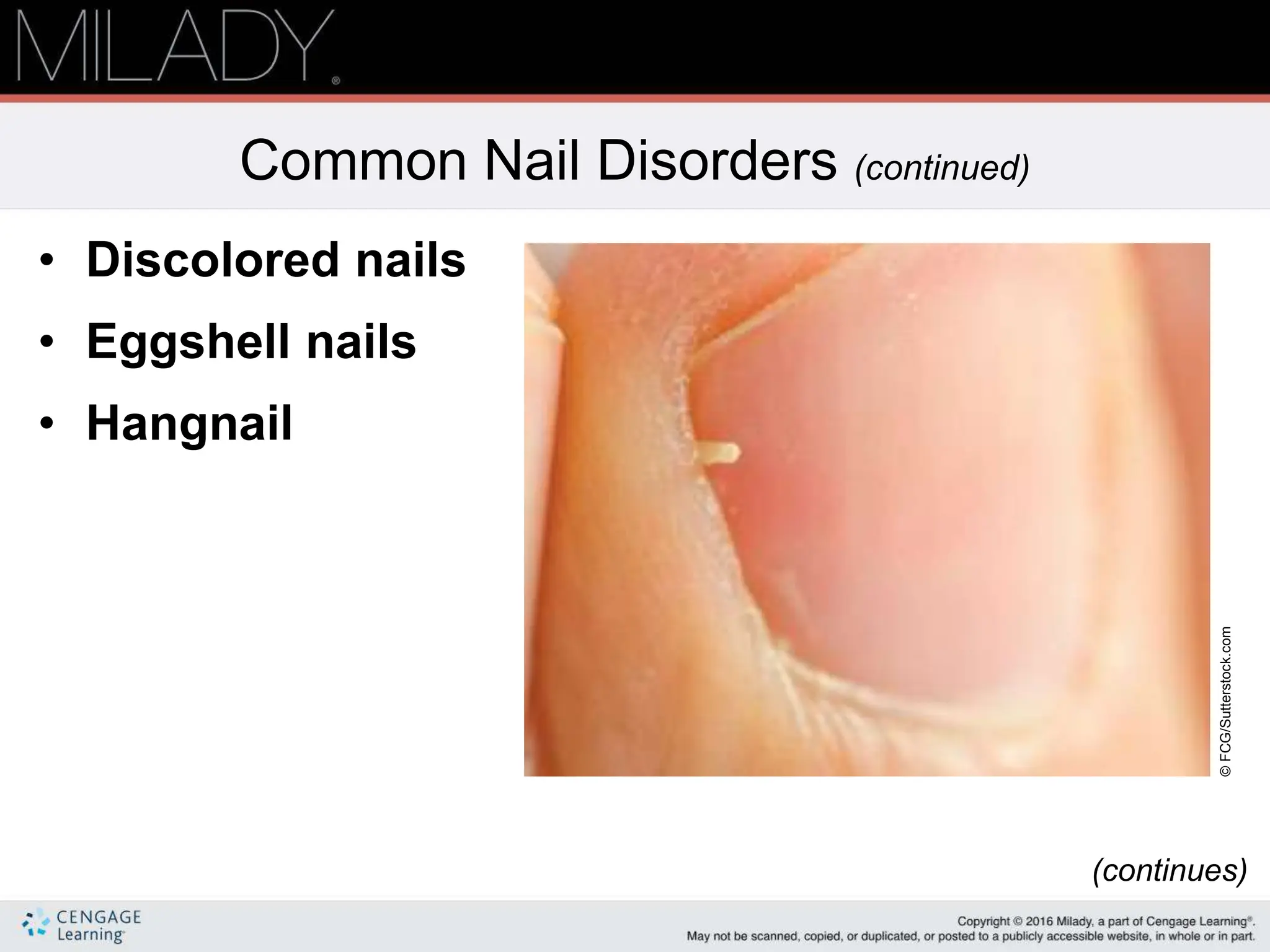 Nail disorders and diseases; Basic Introducion | PPTX