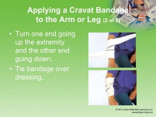 Applying a Cravat Bandage
to the Arm or Leg (2 of 2)
• Turn one end going
up the extremity
and the other end
going down.
• Tie bandage over
dressing.
 