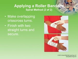 Applying a Roller Bandage
Spiral Method (2 of 2)
• Make overlapping
crisscross turns.
• Finish with two
straight turns and
secure.
 