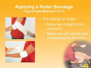 Applying a Roller Bandage
Figure-Eight Method (1 of 7)
• For elbow or knee:
• Make two straight turns
over joint.
• Make one turn above joint,
overlapping the first turn.
 